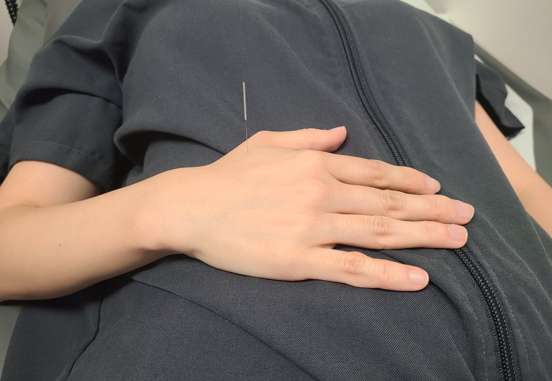 배에 침을 놓은 상태로 쉬는 장면
