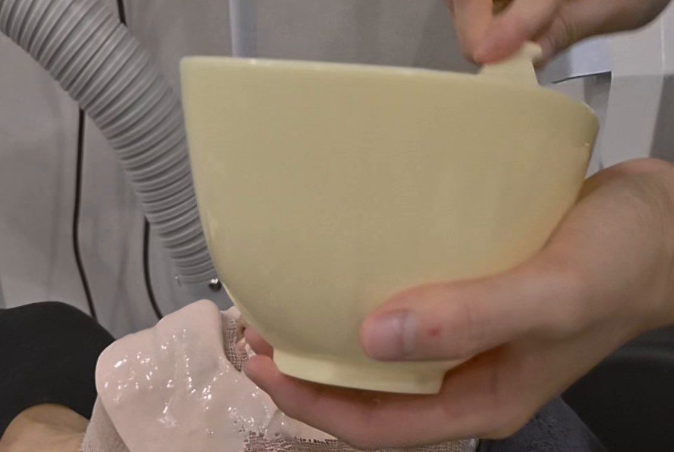 점 · 쥐젖 · 사마귀 시술 장면