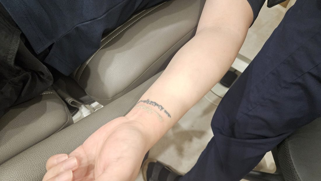 문신 제거 시술 장면
