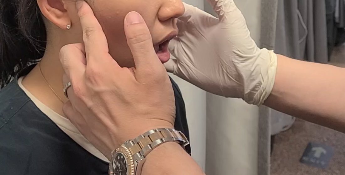 턱관절의 벌어지는 범위를 확인하는 장면