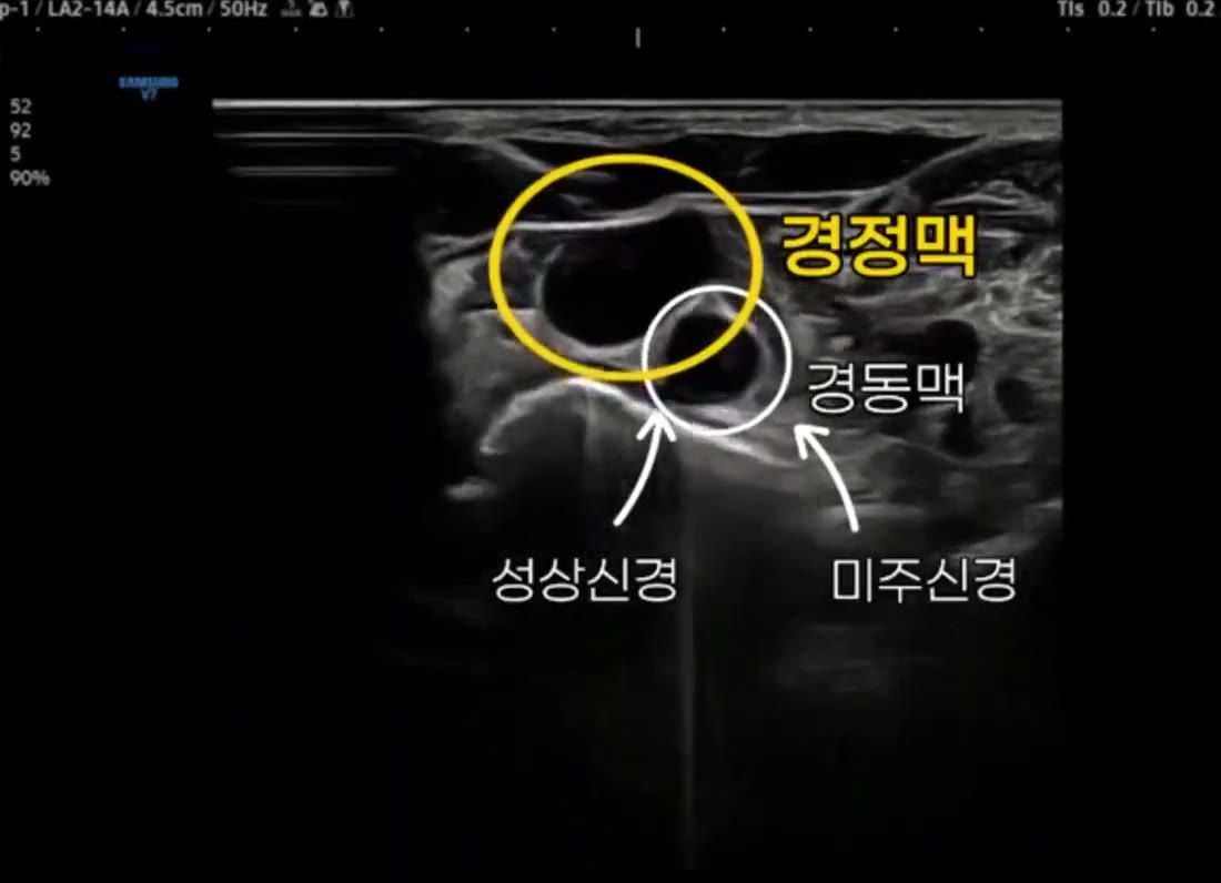 이명 관련 치료 장면