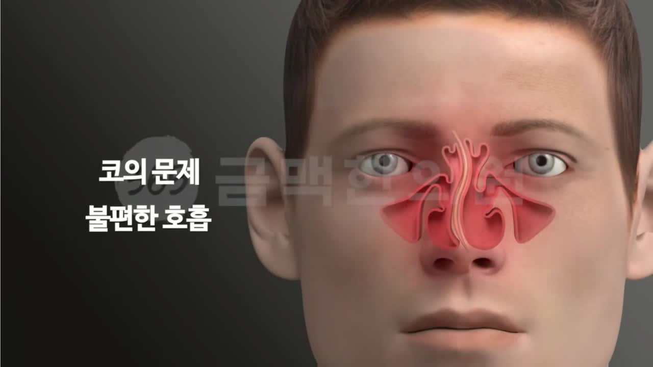 귀 먹먹함·이관 관련 치료 장면